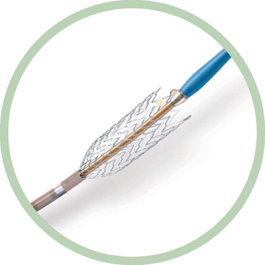 R2P® MISAGO® RX Self-Expanding Peripheral Stent